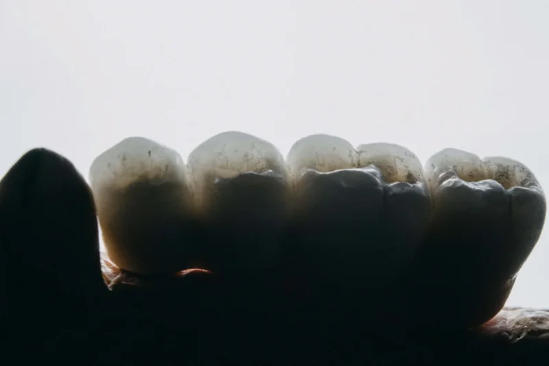 BENT CLINIC 5 ozkan-guner-gCN52lzMOJM-unsplash