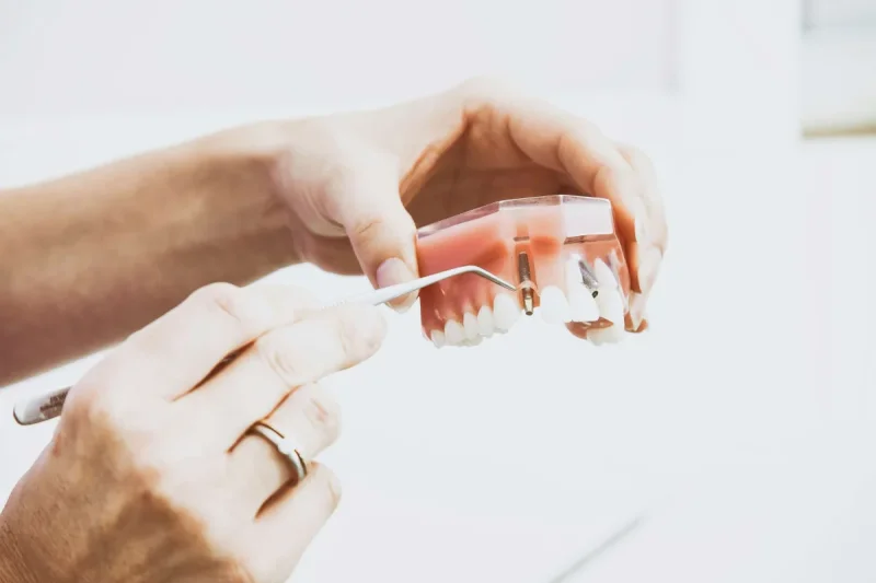 BENT CLINIC 7 zubné implantáty v dentálnej klinike Bentclinic v Nitre